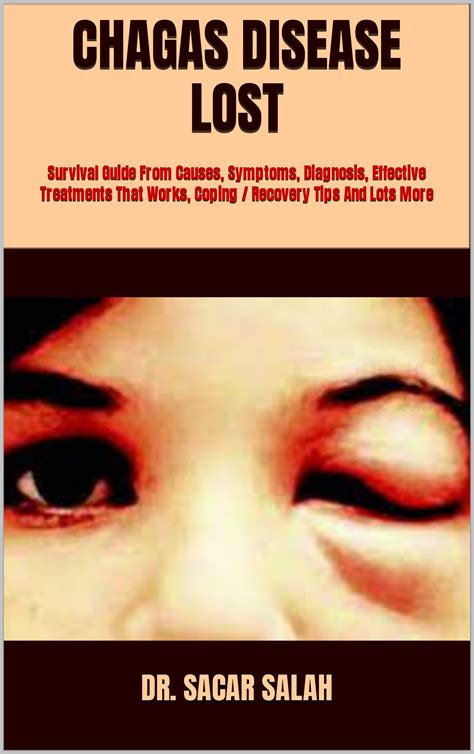 Chagas Disease Lost Survival Guide From Causes Symptoms Diagnosis Effective Treatments That