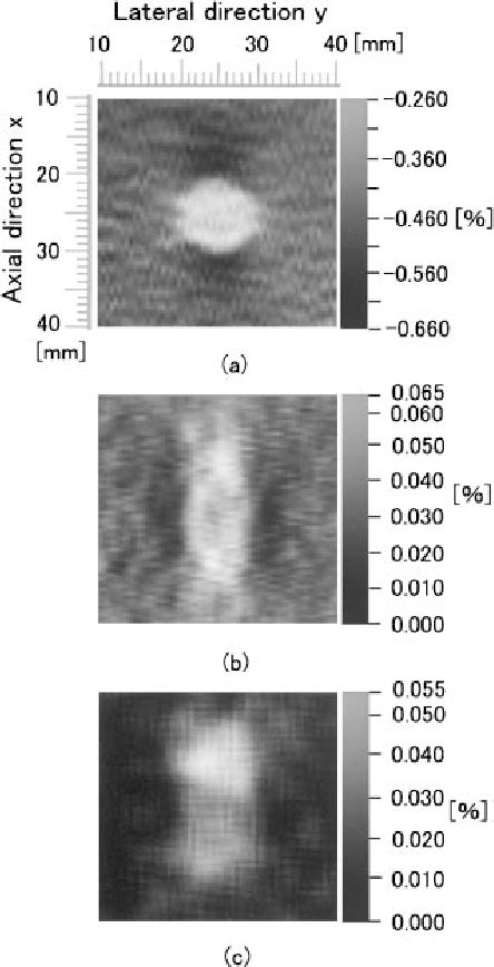 Figure 1 From Relative Shear Modulus Reconstruction For Visualization