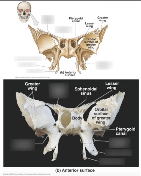 Sphenoid Bone Anterior View Diagram Quizlet