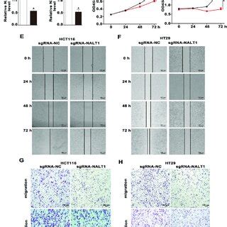 Down Regulation Of Nalt Suppressed Crc Proliferation Migration And