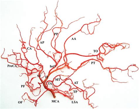 Middle Cerebral Artery Branches