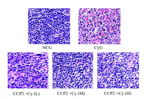 Effects Of Ccp2 On The Spleen Tissues Showed In He Stained Download Scientific Diagram