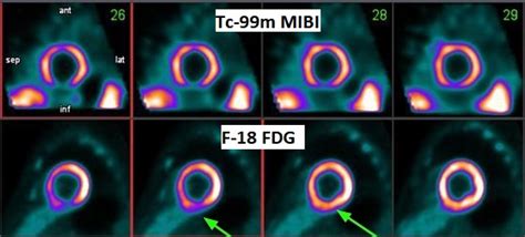 Department of Nuclear Medicine Positron Emission Tomography 同位素及正電子掃描部