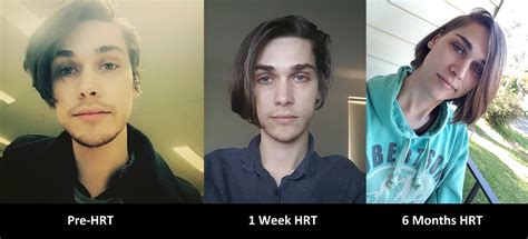 Mtf Pre Hrt To Now 6 Months With No Makeup Or Filter R Transtimelines