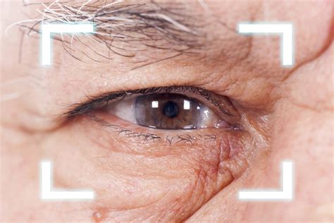 Guide To Cataract Surgery Michigan Eye Institute