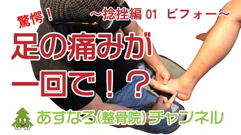 【捻挫へのアプローチ・ビフォー編】重度の左足首の外側の捻挫で、強い痛みと腫れ、内出血がみられて歩行もままならない状態で来院。 Youtube