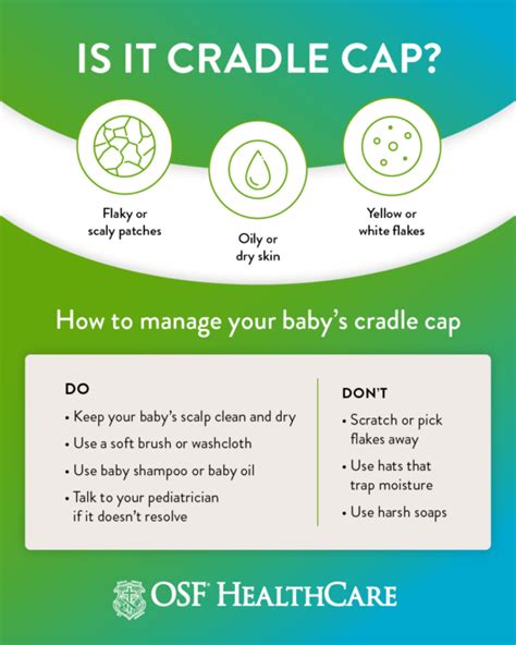 What Is Cradle Cap And How Is It Treated Osf Healthcare