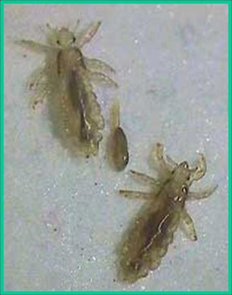 Headlice - Plant & Pest Diagnostics