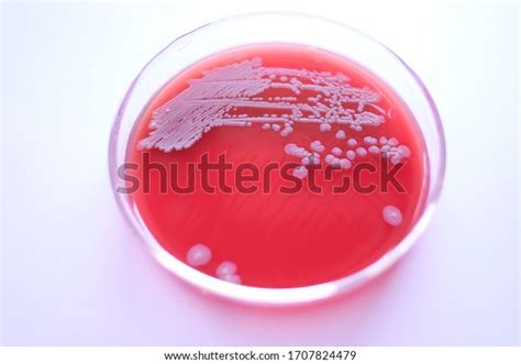 Closeup Bacillus Subtilis Colony Morphology On Stock Photo Edit Now