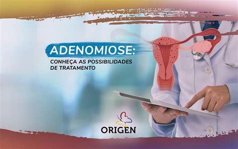 Adenomiose Conhe A As Possibilidades De Tratamento Cl Nica Origen