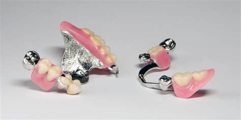 Chrome Dentures Upper Lower Full Partial Cost Newport