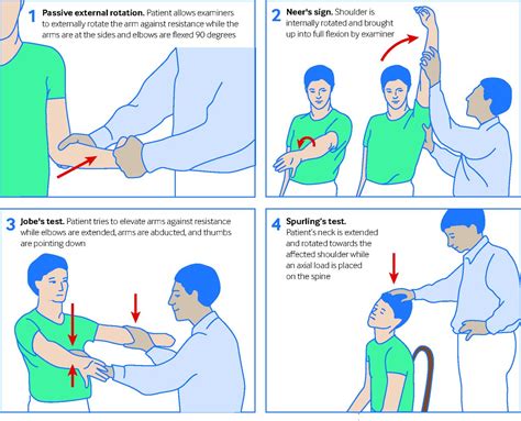 Assessment Of Shoulder Pain For Non Specialists The Bmj