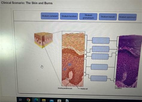 Solved Clinical Scenario The Skin And Burns Chegg