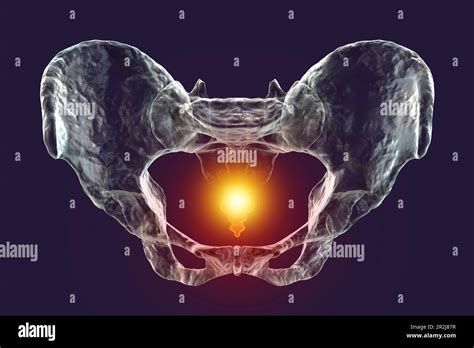 Coccyx Pain Conceptual Illustration Stock Photo Alamy