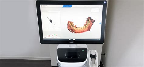 Optischer Digitaler Abdruck Intraoral Scanner Neustadt Waldnaab Dr