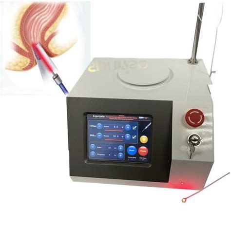 Surgery Treatment For Hemorrhoids Removal Nm Diode Laser