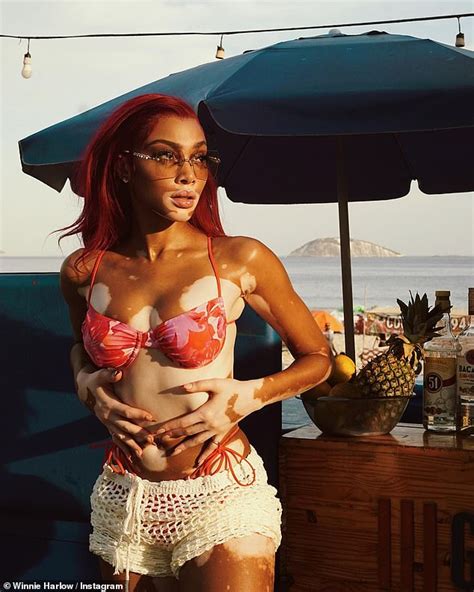 Winnie Harlow Looks Red Hot In A Skimpy Scarlet Bikini For Sizzling Photoshoot In Rio De Janeiro