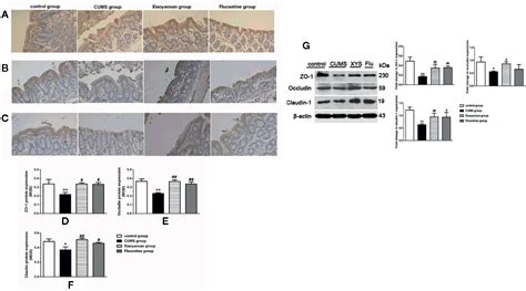 Frontiers Effect Of Xiaoyaosan On Colon Morphology And Intestinal