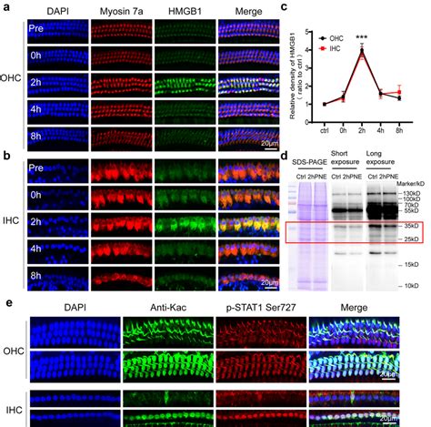 Hmgb1 Accumulation In The Cytoplasm Of Hcs Accompanied By Cellular