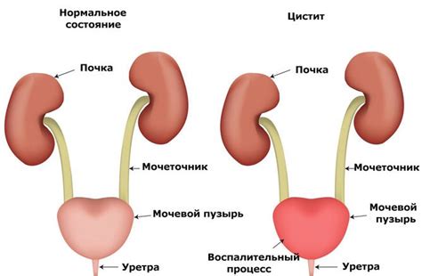 Строение уретры у женщин анатомия в картинках