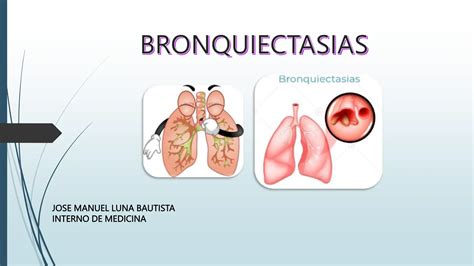 Bronquiectasias Catering Neumolog A Infe Ppt Descarga Gratuita