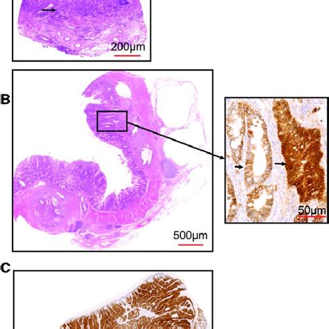 Inflammation Overcomes The Tumour Resistance In The Apc Min Mbd2