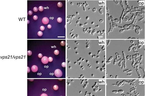 Vps21 Signaling Pathway Regulates White Opaque Switching And Mating In