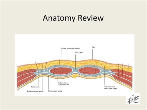 Laparoscopic Inguinal Hernia Repair Tapp