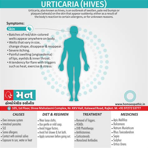 Urticaria (Hives) - Mann Homeopathy Clinic Rajkot