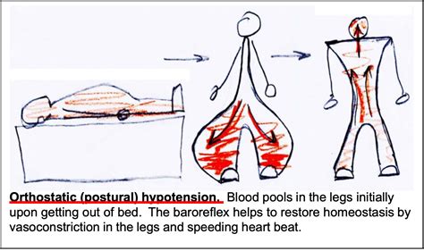 Orthostatic Hypotension Autonomic Nervous System Physiology