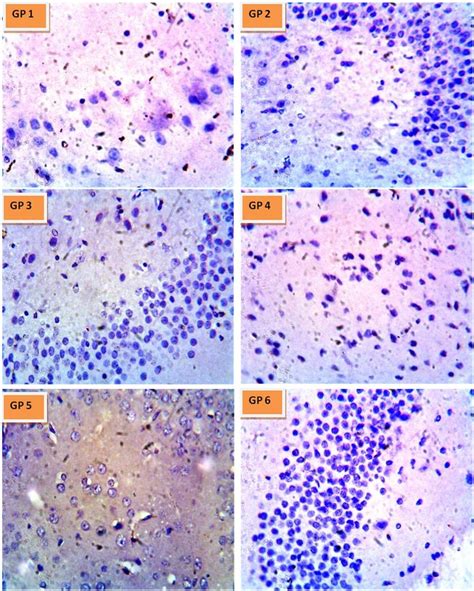 Photomicrograph Showing Immunohistochemistry Labelling Of B Cell