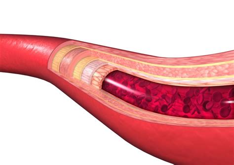 Vldl Normalwerte F R Cholesterin Im Blut