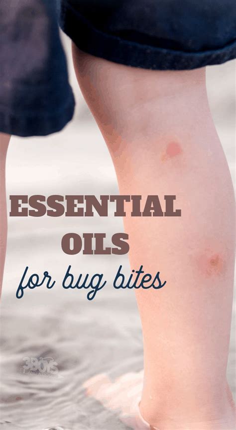 Best Essential Oils To Soothe Summer Bug Bites Essential Oils Bug