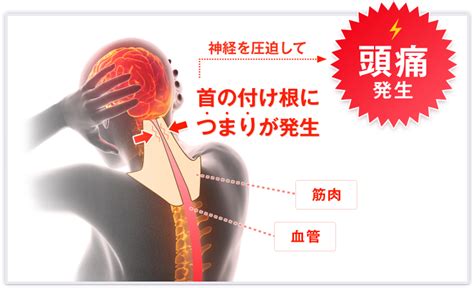 頭痛の治療・原因解決なら 愛知県の頭痛外来【日だまり整体院】