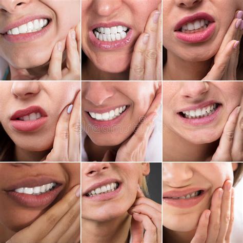 Tooth Decay Pain Sore Mouth Stock Image Image Of Pressure Face