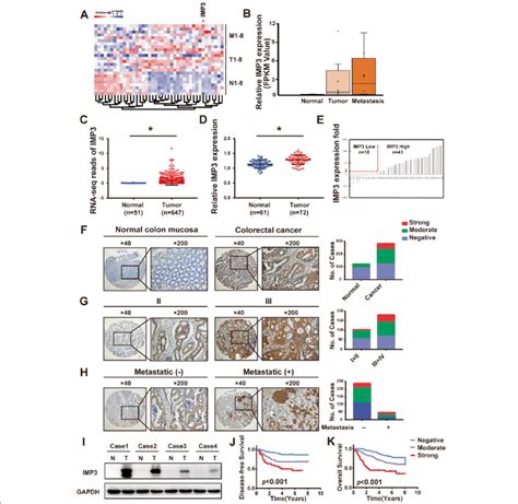 Imp3 Is Upregulated In Human Crc Patients And Predicted Poor Prognosis