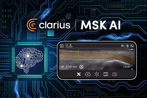 Clarius Announces The First FDA Cleared AI Ultrasound Application For