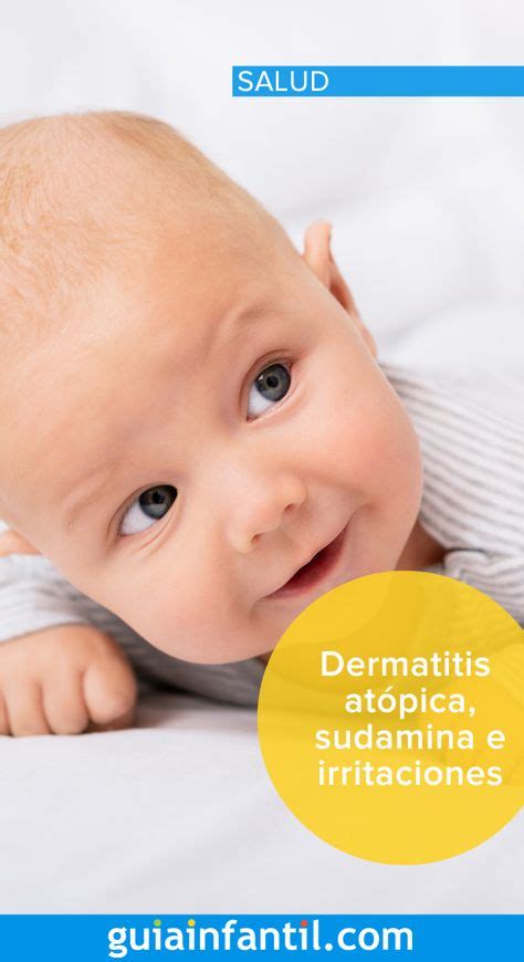 Dermatitis Sudamina E Irritaciones En La Piel De Los Ni Os