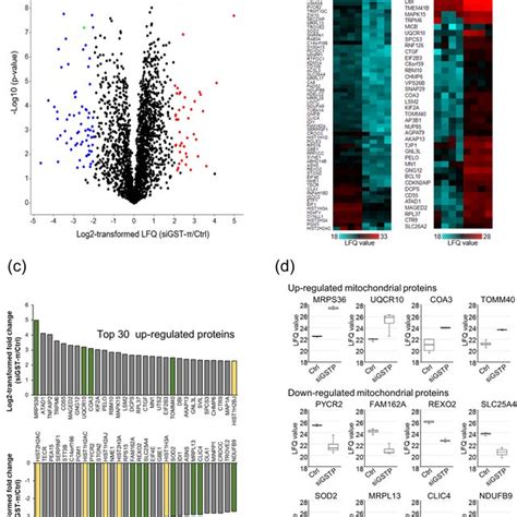 Genotyping Of Gstm And Gstt By Multiplex Pcr M Bp Dna Marker