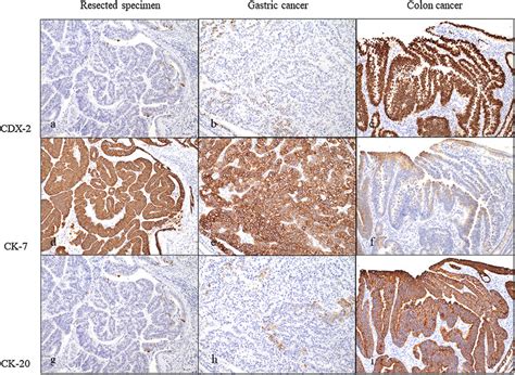 Immunohistochemical Staining Magnification 100 A C CDX 2 Levels