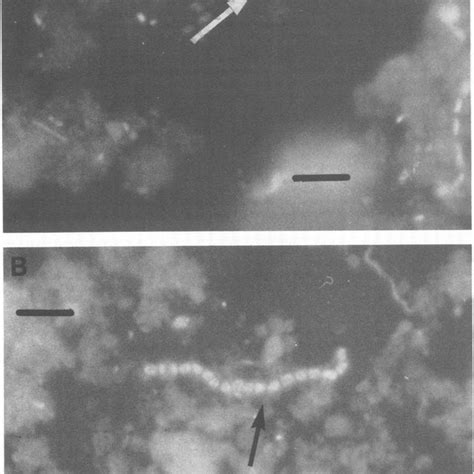 Reflective fluorescence photomicrographs of acridine orange-stained ...