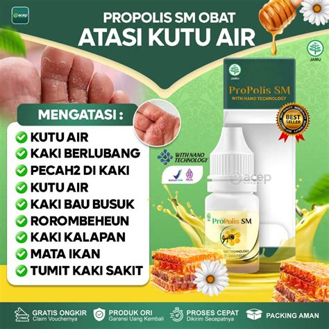 Jual Obat Kutu Air Pada Sela Jari Kaki Gatal Parah Di Tangan Penghilang