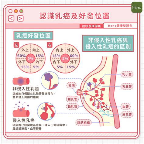 乳癌是婦女健康殺手第一名！一次詳解症狀、分期、存活率與成因 Heho健康