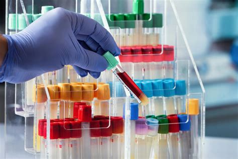 Breakthrough blood test predicts schizophrenia risk, best treatments