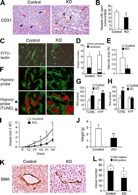 Effects Of Endothelial Hif 2 Deletion On Tumor Angiogenesis A