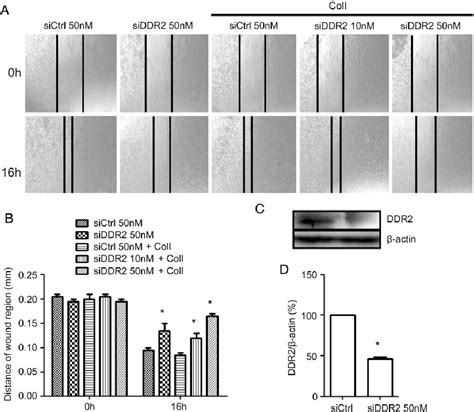 Figure From Ddr Inhibition Reduces Migration And Invasion Of Murine