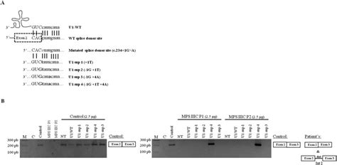 Modified U1 snRNA therapeutic approach to correct the pathogenic effect ... 