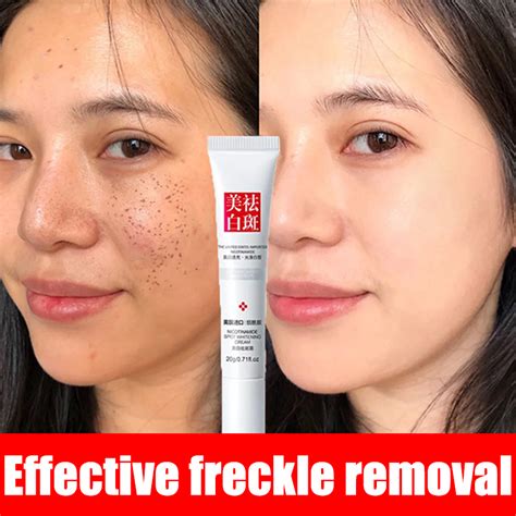 Fast Effective Freckle Removal Whitening Cream Retinol Serum For Face