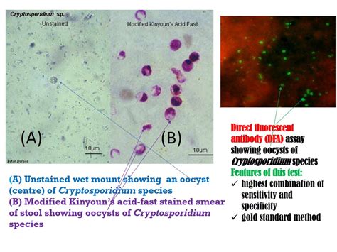 Cryptosporidium Introduction Morphology Life Cycle Pathogenecity