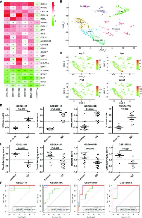 Identification Of The Glandular Transcriptomic Signature For Sj Gren S